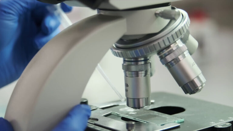 La sfida dell’innovazione per la salute dei reni